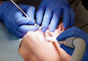 dental implants Whetstone