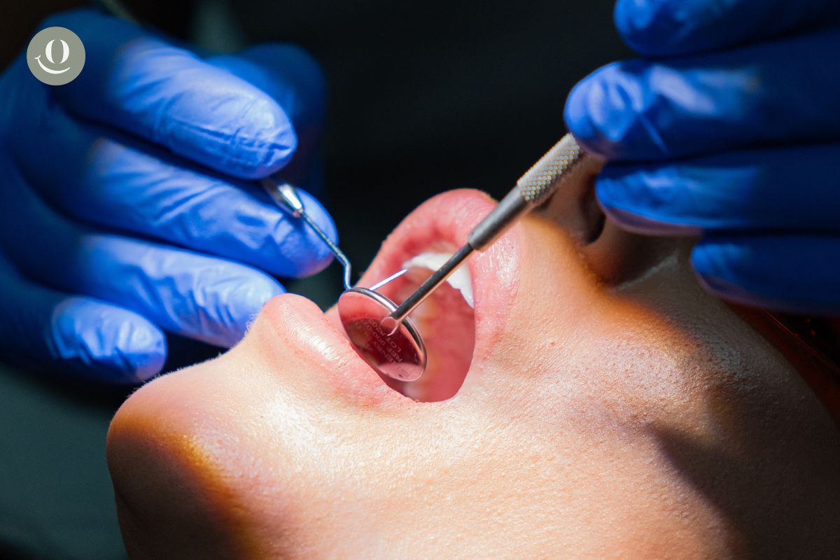 root canal treatment